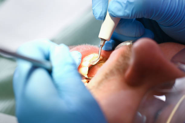 Best Holiday Emergency Dentist in West Chatham, MA